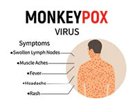 Symptoms of monkeypox.