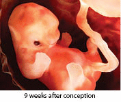 An fetus at 9 weeks after conception